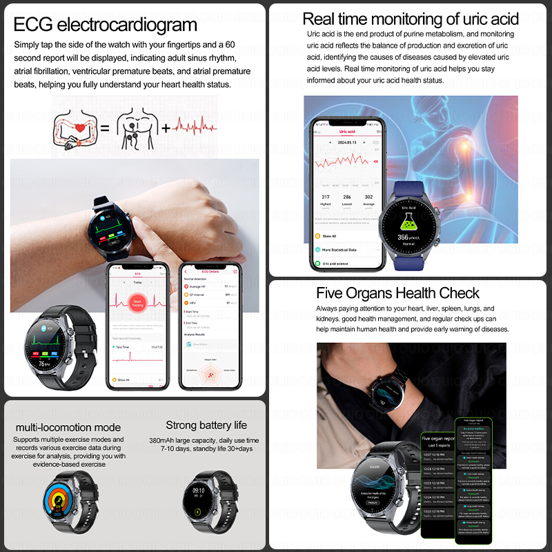 สมาร์ทวอทช์รุ่นใหม่ปี 2026 อัป - Smartwatch Watches For Women Brands บทวิจารณ์และราคา